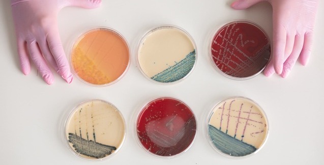 Бактериологическое исследование: методы и результаты