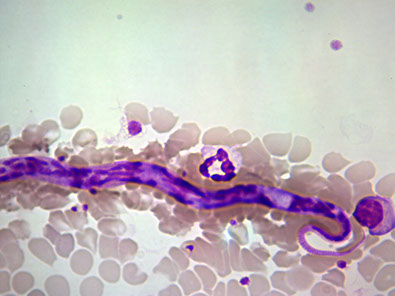 diagnostika-dirofilyarioza-u-sobak-v-sankt-peterburge-mikrofilyariya-ieu7587-fr.png