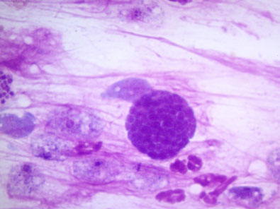 lechenie-i-diagnostika-dirofilyarioza-sobak-yajcevye-shary-dirofilaria-repence-ieu7579-fr.png