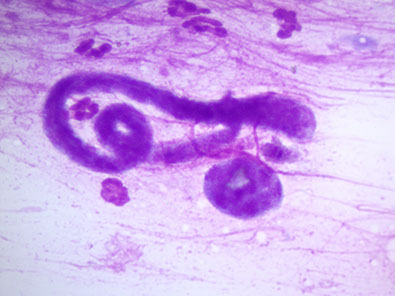 lechenie-dirofilyarioza-sobak-mikrofilyarii-dirofilaria-immitis-ieu7583-fr.png lechenie-dirofilyarioza-sobak-mikrofilyarii-dirofilaria-immitis-ieu7583-fr.png