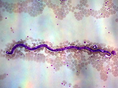 diagnostika-dirofilyarioza-u-sobak-v-sankt-peterburge-mikrofilyariya-dirofilaria-immitis-ieu7595-fr.png