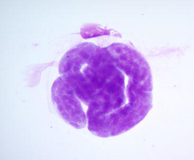 lechenie-dirofilyarioza-sobak-mikrofilyarii-dirofilaria-repence-ieu7603-fr.png lechenie-dirofilyarioza-sobak-mikrofilyarii-dirofilaria-repence-ieu7603-fr.png